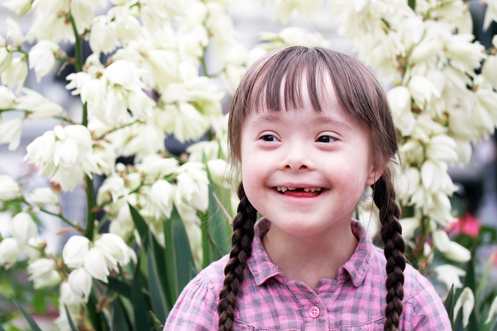 A girl with Down syndrome